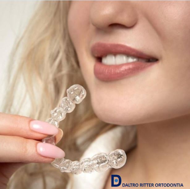 invisalign