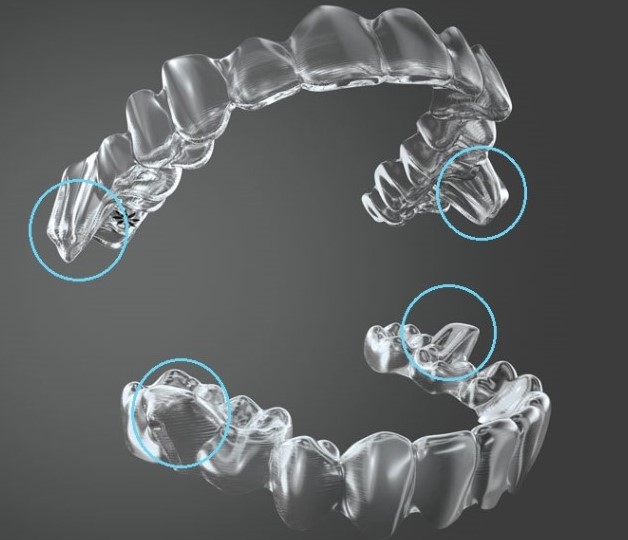 Invisalign em crianças